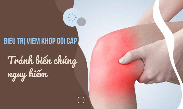 Kịp thời điều trị viêm khớp gối cấp – tránh biến chứng nguy hiểm