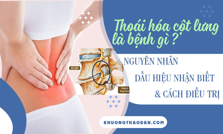 Thoái hóa cột sống lưng là gì? Tổng hợp những điều cần biết về thoái hóa cột sống lưng