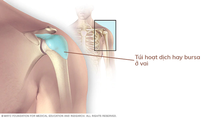 Đau Vai Trái Là Bệnh Gì? Cách Chữa Đau Vai Trái