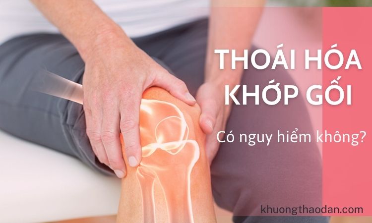 Thoái hóa khớp gối có nguy hiểm không?