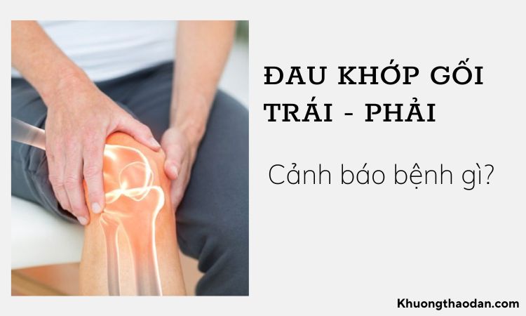 Đau khớp gối bên trái hoặc phải cảnh báo bệnh gì?